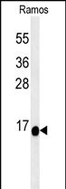 C1orf186 Antibody (RB27426)