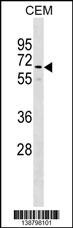 Golgin-67 / GM88 Autoantigen Antibody (RB38798)