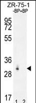 RAB40AL Antibody (RB31643)
