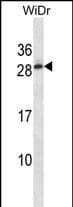 C11orf20 Antibody (RB34885)
