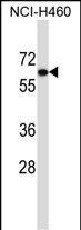 UGT2B11 Antibody (RB33523)