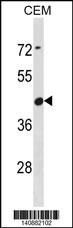 ZNG1F Antibody (RB40882)