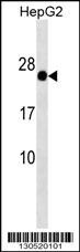 G antigen 12F/G/I Antibody (RB30520)