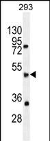 SPDYE5 Antibody (RB29743)