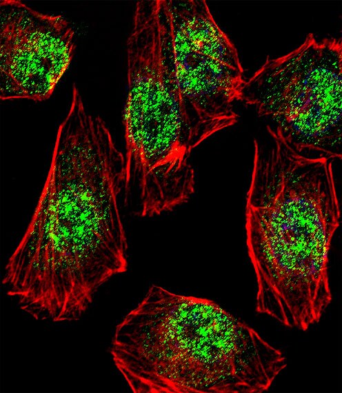 RHOXF2B Antibody (RB39659)