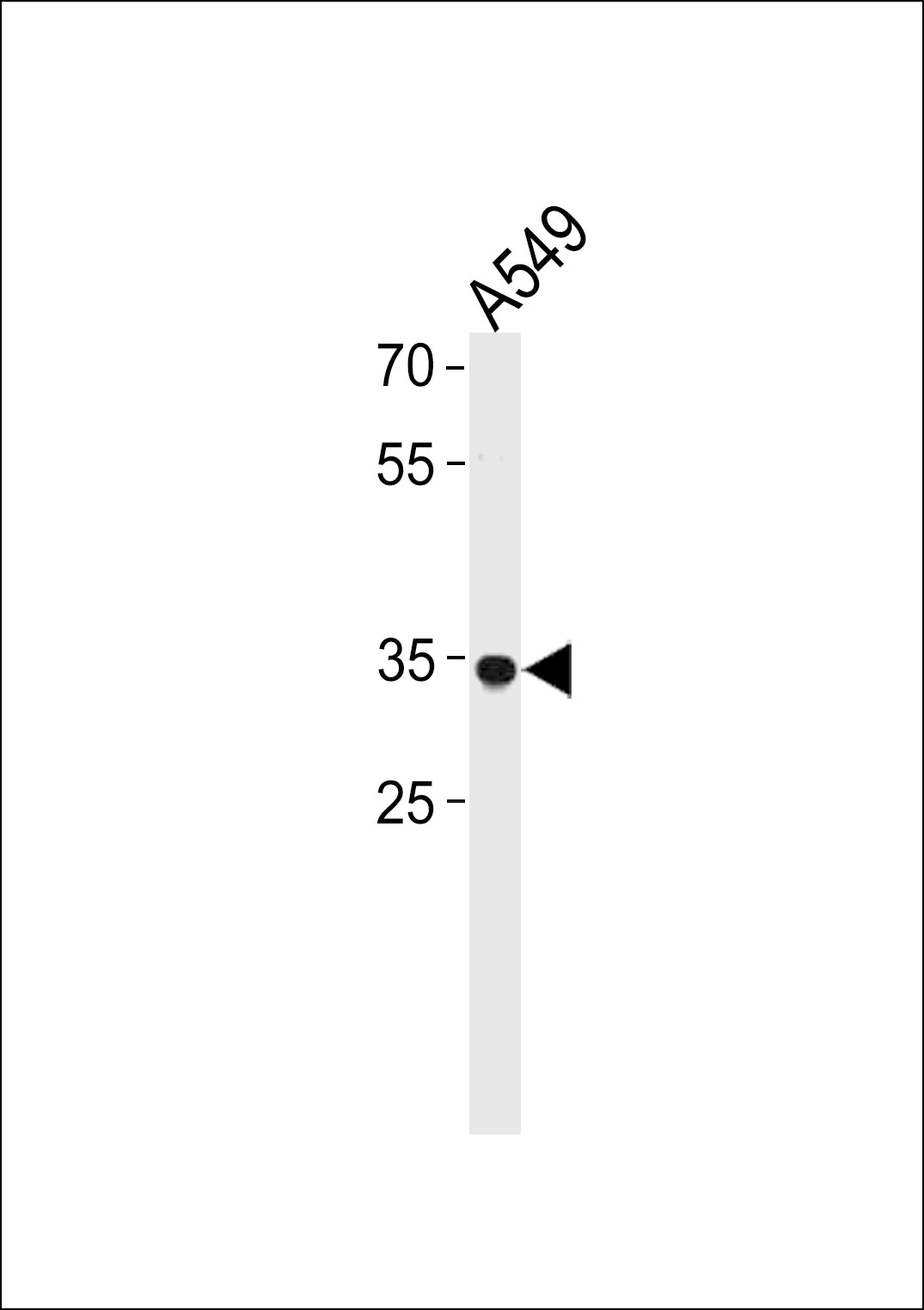 RHOXF2B Antibody (RB39659)