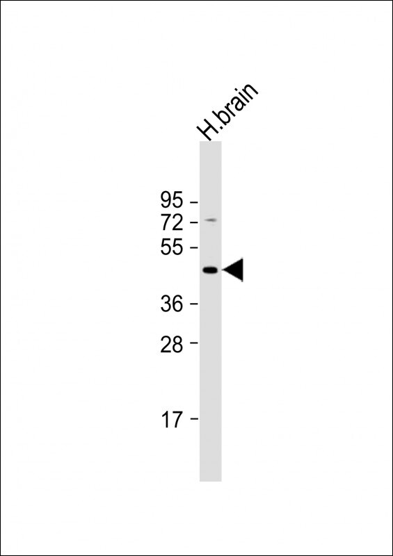 GABA-A R rho 3 Antibody (RB31431)