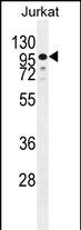 ZNF841 Antibody (RB29274)