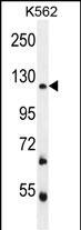 FBRSL1 Antibody (RB29571)