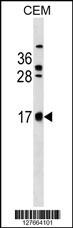 C2orf83 Antibody (RB27664)