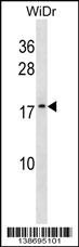 ATP5L2 Antibody (RB38695)