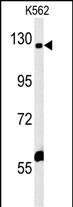 IQSEC3 Antibody (RB27469)