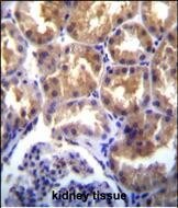 TRPM6 Antibody (RB3407)