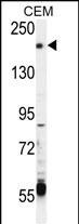 TRPM6 Antibody (RB3407)