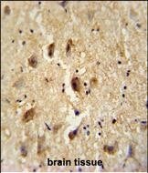 Vitrin Antibody (RB27060)