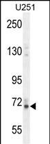 Vitrin Antibody (RB27060)