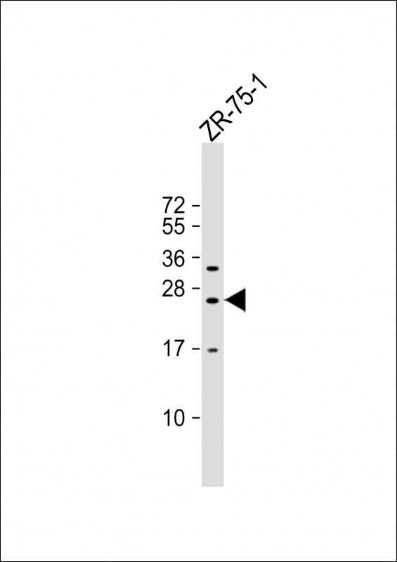 NKp65/KLRF2 Antibody (RB38872)