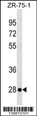 NKp65/KLRF2 Antibody (RB38872)