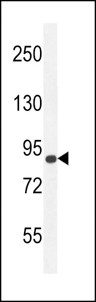 AGAP9 Antibody (RB29382)