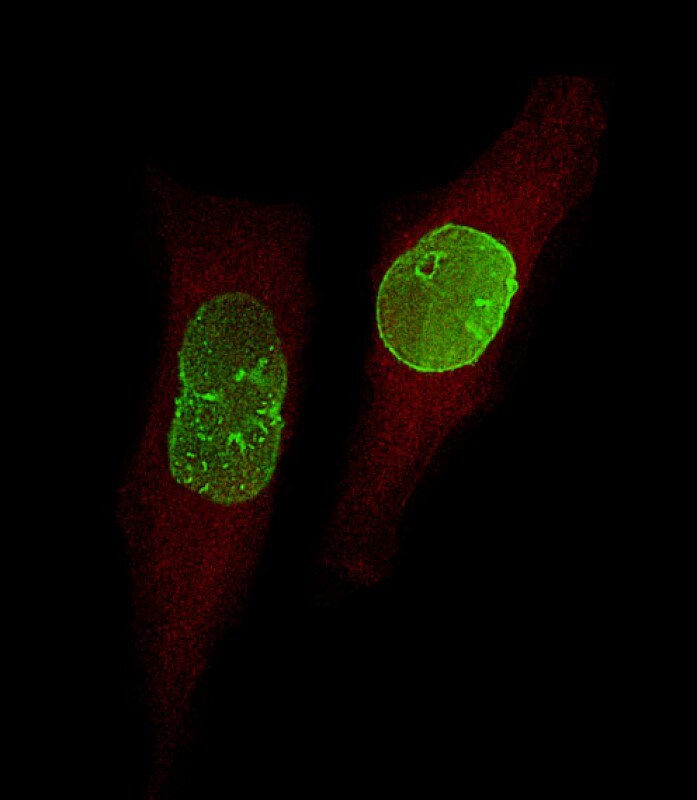 USP17 Antibody (RB26955)