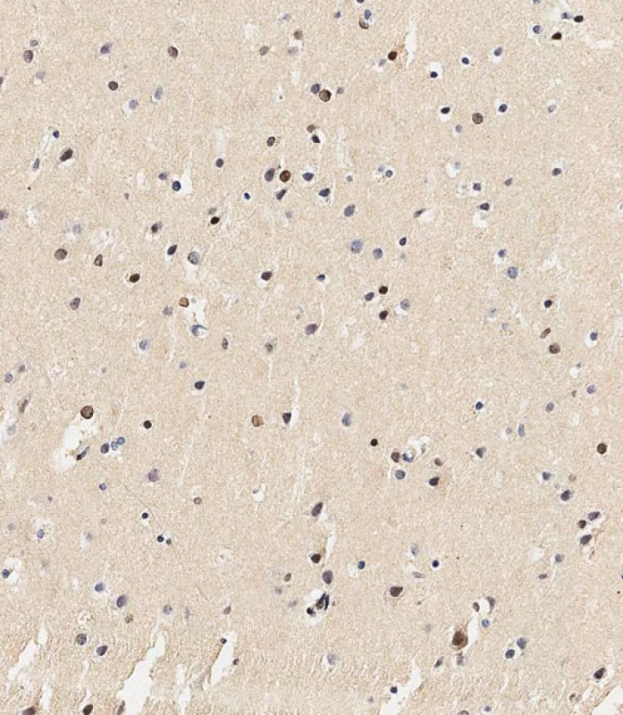 USP17 Antibody (RB26955)