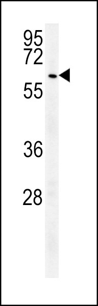 USP17 Antibody (RB26955)