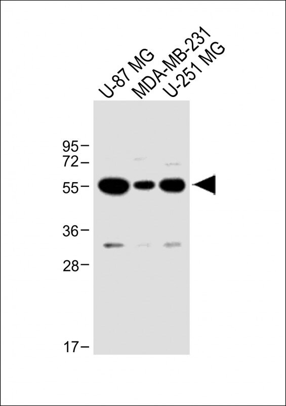 USP17 Antibody (RB26955)