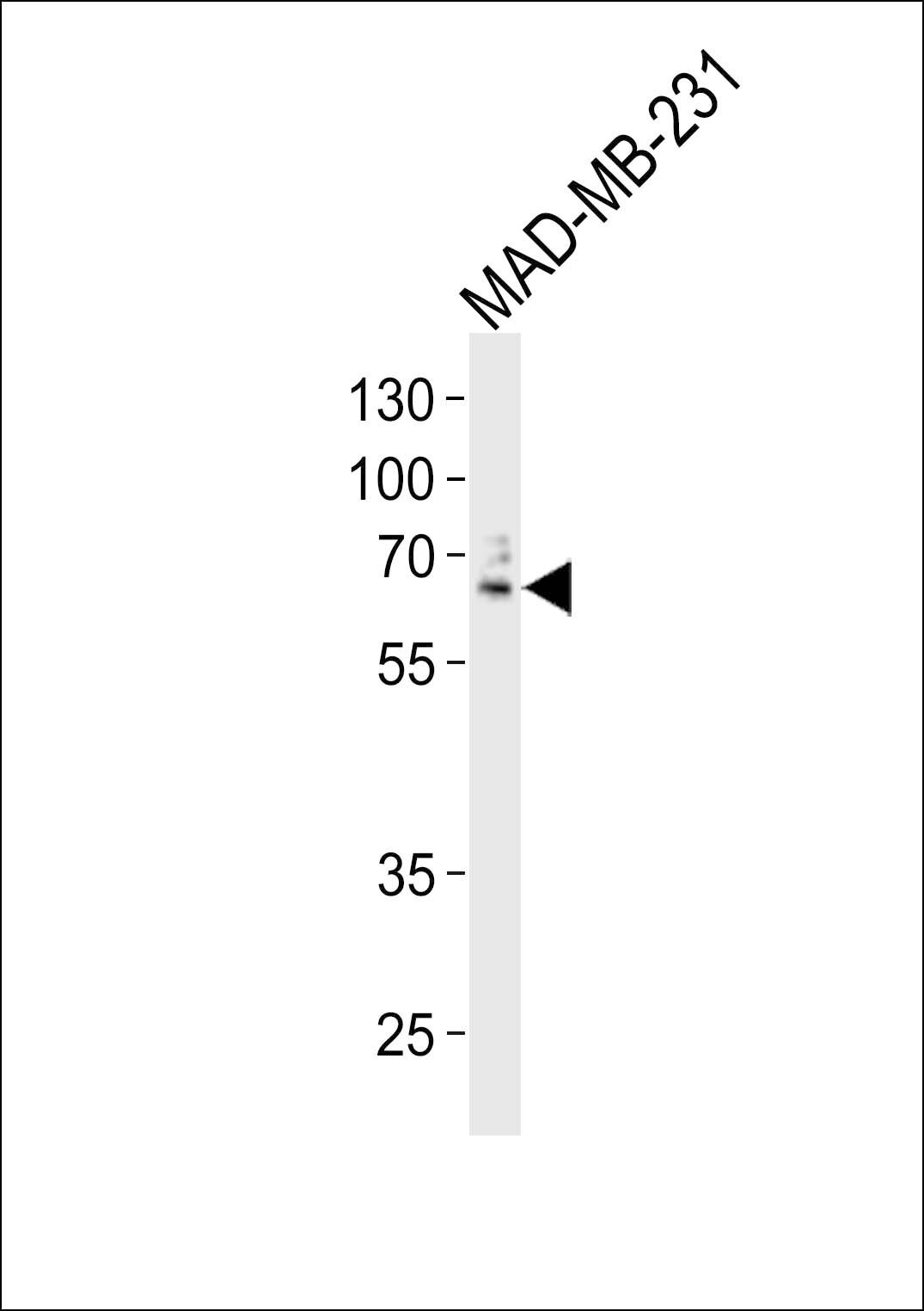 USP17 Antibody (RB26955)