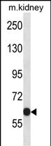 Kv3.2 Antibody (RB33946)