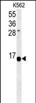 HIST1H2AK Antibody (RB26883)