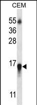 HIST1H2BN Antibody (RB32147)