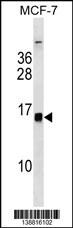 HIST1H2BH Antibody (RB38816)