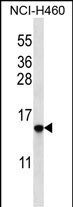 HIST1H2BO Antibody (RB32148)