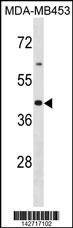 OR2B6 Antibody (RB42717)