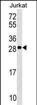 ANP32C Antibody (RB37230)