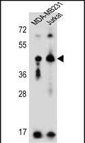 KIR2DL2/CD158b1 Antibody (RB23818)
