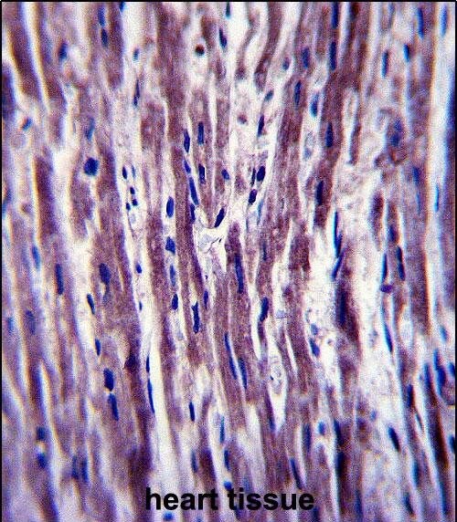 PTPLA Antibody (RB33378)