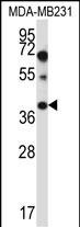 PTPLA Antibody (RB33378)