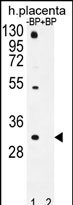 OR1D5 Antibody (RB31649)
