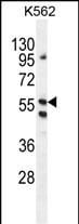 PAL/LRIT1 Antibody (RB29447)