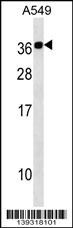 Calcium binding protein 2 Antibody (RB39318)