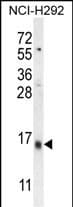 Ly-6G6C Antibody (RB27560)