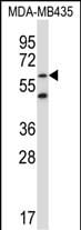 ZNF479 Antibody (RB33997)