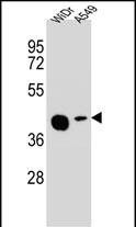 SLC35G5 Antibody (RB28471)