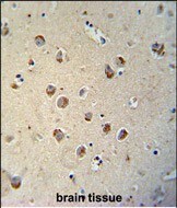 Tectorin Beta Antibody (RB27701)