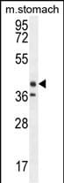 Tectorin Beta Antibody (RB27701)