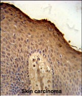 Isthmin 1/ISM1 Antibody (RB25991)