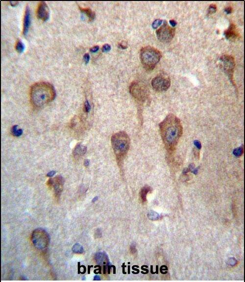 GPHB5 Antibody (RB33067)