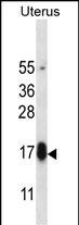 GPHB5 Antibody (RB33067)