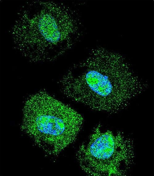 FAM218A Antibody (RB29001)